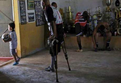 Un portero de fútbol con una sola pierna. Un ejemplo de superación. Un portero de fútbol que juega con una sola pierna