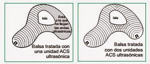 Sistema de control de algas (ACS) de RAIN BIRD Sistema de control de algas (ACS) de RAIN BIRD