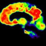 Rigidez arterial y progresión de β-Amiloide en adultos mayores sin demencia. PiB_PET