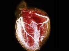 ¿Puede el corazón roto ser una causa de muerte?