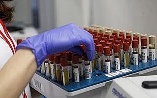 Varias investigaciones en marcha para detectar el cáncer en la sangre Varias investigaciones en marcha para detectar el cáncer en la sangre