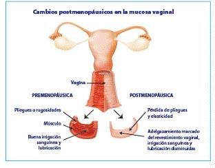 La menopausia exacerba o desencadena la aparición de problemas vaginales