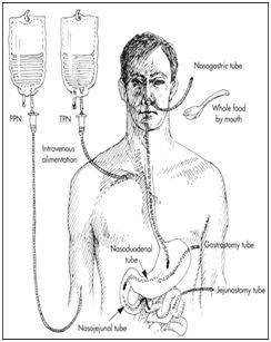 parentenal