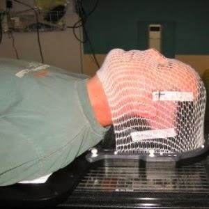 La radioterapia en el Cáncer del Sistema Nervioso Central La radioterapia en el Cáncer del Sistema Nervioso Central