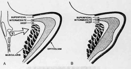 ¿Cómo puedo aumentar mi resistencia vocal? esquema cuerdas vocales