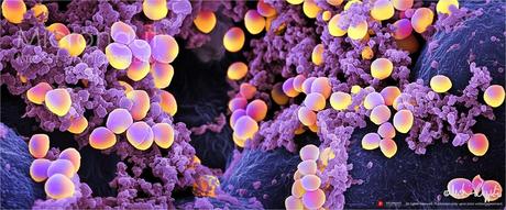 Elige bien a tu comensal... hoy con staphylococcus Elige bien a tu comensal... hoy con staphylococcus