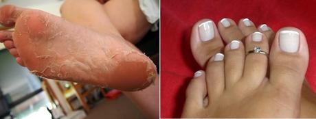 PREPARA EN CASA UN EXFOLIANTE PARA TUS PIES PREPARA EN CASA UN EXFOLIANTE PARA TUS PIES