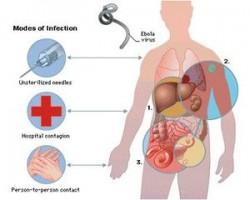 ebola vias contagio 250x200 Qué es el Ébola?