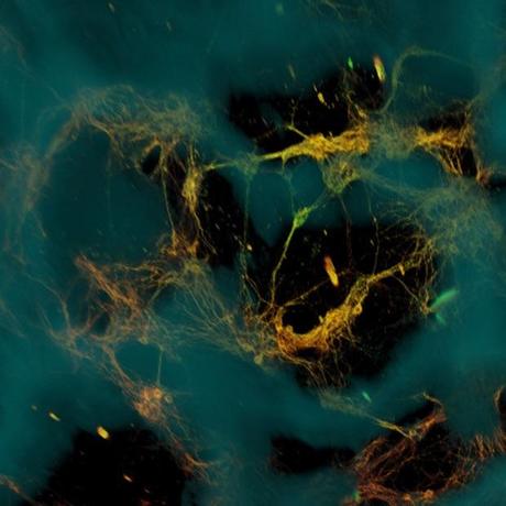 Bioingenieros crean tejido cerebral funcional en 3D Neuronas 3D