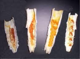 Cómo limpiar el oído de forma natural Cómo limpiar el oído de forma natural