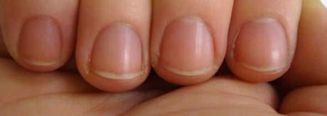 sintomas en las uñas que no debes ignorar