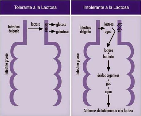 Intolerancia a la lactosa, pocos nos tienen en cuenta