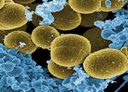 Staphylococcus-aureus-UMF
