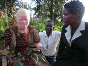 Los albinos, los hijos del diablo Flickr. Osoro Nyawangah