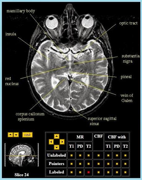 Imágenes de un cerebro real en vivo