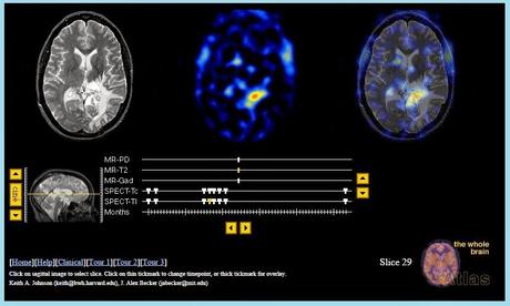 Imágenes de un cerebro real en vivo