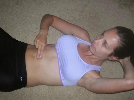 Diástasis abdominal Diástasis abdominal