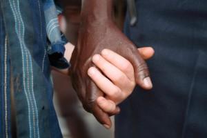 Los albinos, los hijos del diablo Flickr. IFRC