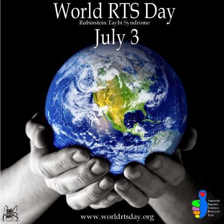 El 3 de julio es el día internacional del Síndrome de Rubinstein-Taybi