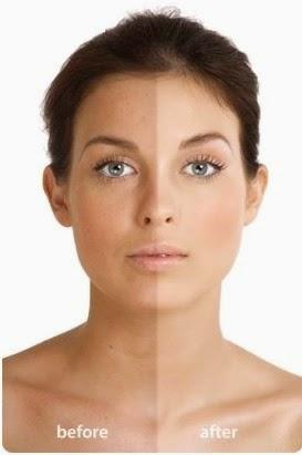 ¿POR QUÉ ES TAN DIFÍCIL DE TRATAR EL MELASMA?