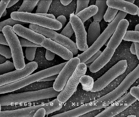 TU BOLSO ES UN FOCO DE INFECCIÓN TU BOLSO ES UN FOCO DE INFECCIÓN