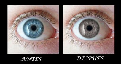 LAS 5 CIRUGÍAS ESTÉTICA MÁS RARAS DEL MUNDO Ojos