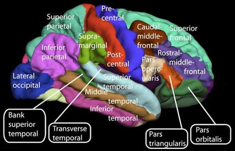 Sin la mitad del cerebro