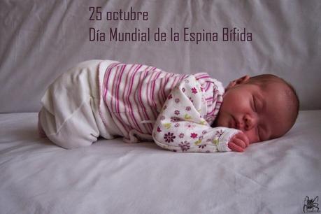 El 25 de octubre es el día mundial de la espina bífida