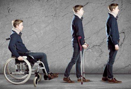 Parálisis Temporal Parálisis temporal