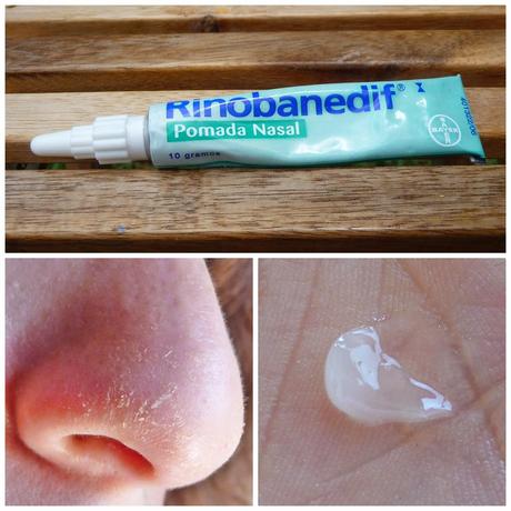 Remedio infalible para una nariz despellejada Remedio infalible para una nariz despellejada