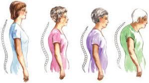 Pilates y Osteoporosis