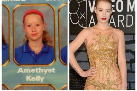 Iggy Azalea antes y después