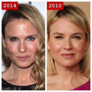 renee-zellweger-plastic-surgery-2014