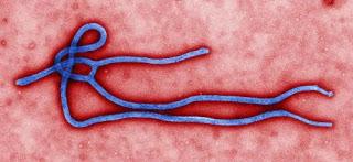 Virus del ébola al microscopio