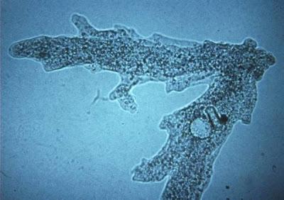 Reino protista Reino protista