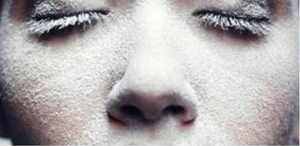 ¿Cómo proteger nuestra piel en invierno? cuidado-piel-frio-invierno