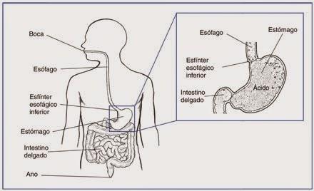 El reflujo gastroesofágico, ¿qué es y cómo tratarlo? El reflujo gastroesofágico, ¿qué es y cómo tratarlo?