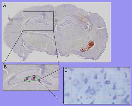 Crean fármaco para reducir los efectos secundarios de las Crean fármaco para reducir los efectos secundarios de las