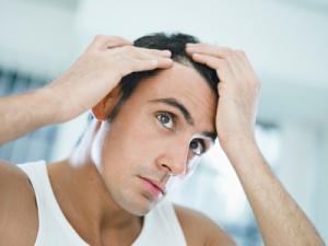 Como Controlar la Caida del Cabello para Hombres Como Controlar la Caida del Cabello para Hombres