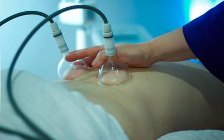 CONCHA VELA Y EL MÉTODO PIROCHE CONCHA VELA Y EL MÉTODO PIROCHE