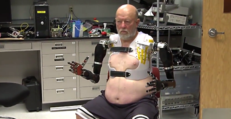 Logran que un amputado pueda controlar dos brazos robóticos sólo con el cerebro protesis-brazos.png