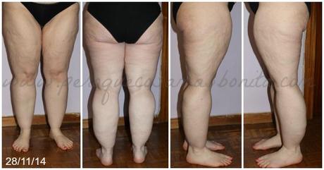 Reporte tras 3 semanas usando Silk'n Silhouette Reporte tras 3 semanas usando Silk'n Silhouette