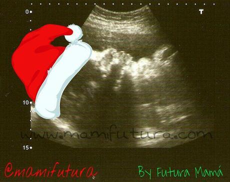 Visita a mi Ginecóloga: Revisión del Embarazo Semana 32 Feliz Navidad