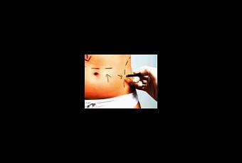 Signos sntomas dieta para adelgazar en una semana el abdomen azcares, miel Prudencia, dieta para adelgazar en una semana el abdomen