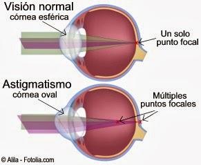 Enfermedades más comunes de los Ojos (Parte II) Enfermedades más comunes de los Ojos (Parte II)