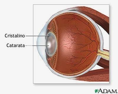 Enfermedades más comunes de los Ojos (Parte II) Enfermedades más comunes de los Ojos (Parte II)