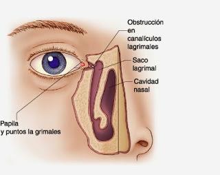 Enfermedades más comunes de los Ojos (Parte I) Enfermedades más comunes de los Ojos (Parte I)