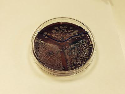 La Mastitis ¿qué es?. Mi práctica en la Universidad Complutense. La Mastitis ¿qué es?. Mi práctica en la Universidad Complutense.