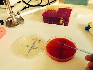 La Mastitis ¿qué es?. Mi práctica en la Universidad Complutense. La Mastitis ¿qué es?. Mi práctica en la Universidad Complutense.