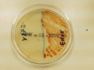 La Mastitis ¿qué es?. Mi práctica en la Universidad Complutense. La Mastitis ¿qué es?. Mi práctica en la Universidad Complutense.